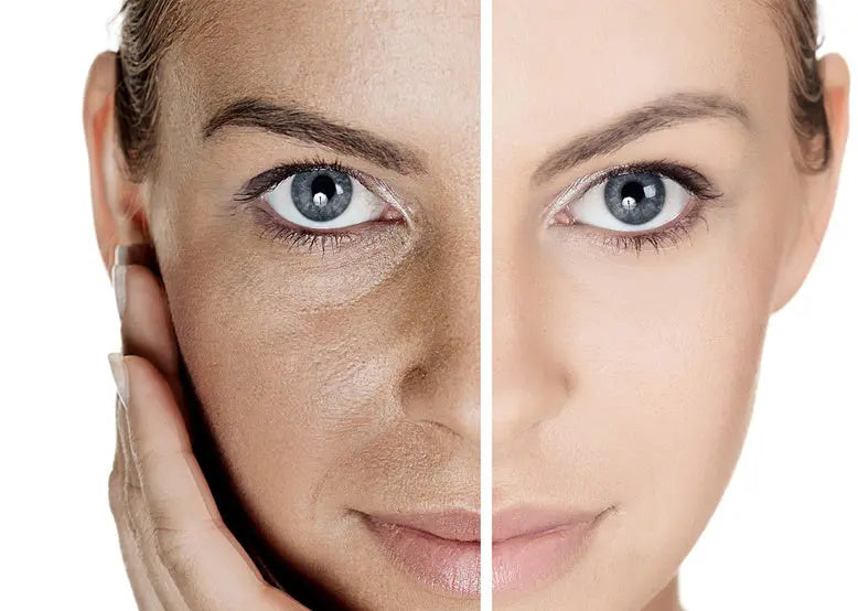 poriën reinigen schoonheidssalon